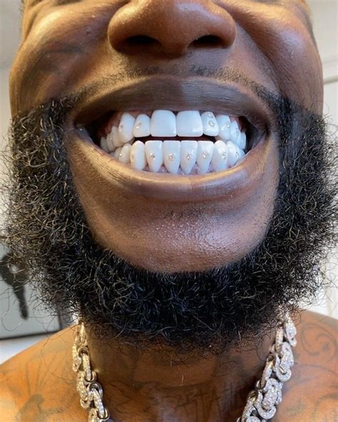 does gucci mane have fake teeth|Gucci Mane Shows Off Diamond.